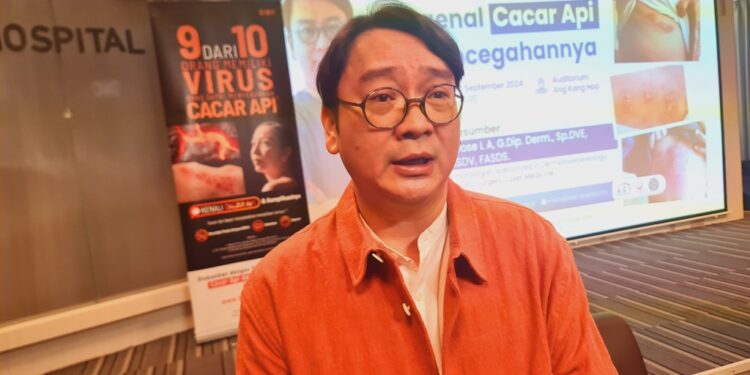 Herpes Zoster: Ancaman Nyata Bagi Orang Dewasa, usia 50 Tahun dan Penderita Gangguan Imunitas, Pencegahan Melalui Vaksinasi Kini Tersedia